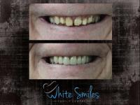 White Smiles Family Dental image 2